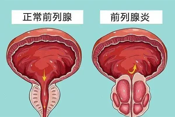 半个月手一次的频率正常吗？探讨个人习惯与健康之间的微妙平衡